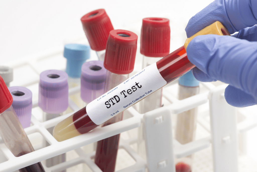 Free STD Testing